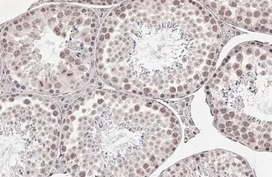 Anti-Peregrin antibody [HL2064] used in IHC (Paraffin sections) (IHC-P). GTX637968