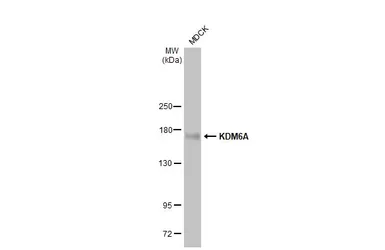 Anti-KDM6A antibody [HL2068] used in Western Blot (WB). GTX637972