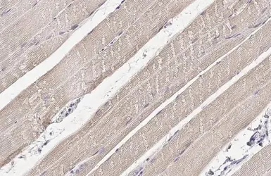 Anti-ALP / PDLIM3 antibody [HL2075] used in IHC (Paraffin sections) (IHC-P). GTX637983