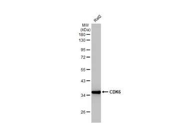 Anti-CDK6 antibody [HL2078] used in Western Blot (WB). GTX637986