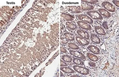 Anti-CDK6 antibody [HL2078] used in IHC (Paraffin sections) (IHC-P). GTX637986
