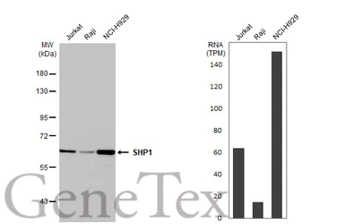 Anti-SHP1 antibody [HL20845] used in Western Blot (WB). GTX637993