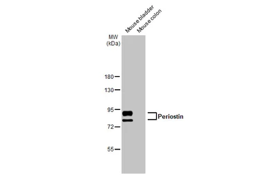 Anti-Periostin antibody [HL2112] used in Western Blot (WB). GTX638084