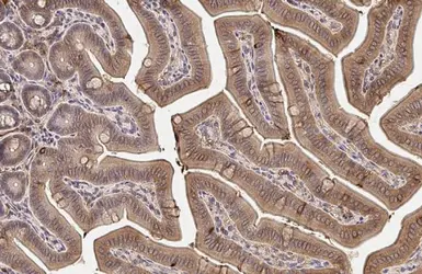 Anti-MAP3K8 antibody [HL2118] used in IHC (Paraffin sections) (IHC-P). GTX638090