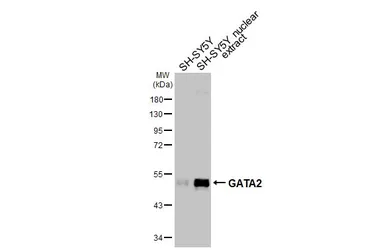 Anti-GATA2 antibody [HL2127] used in Western Blot (WB). GTX638099