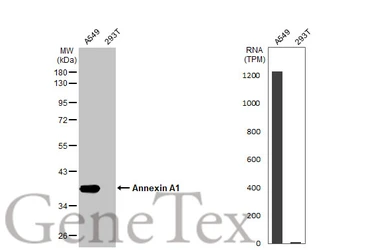 Anti-Annexin A1 antibody [HL2141] used in Western Blot (WB). GTX638119