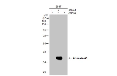 Anti-Annexin A1 antibody [HL2141] used in Western Blot (WB). GTX638119