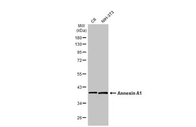Anti-Annexin A1 antibody [HL2141] used in Western Blot (WB). GTX638119