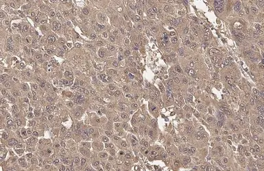 Anti-ADFP antibody [HL2145] used in IHC (Paraffin sections) (IHC-P). GTX638123