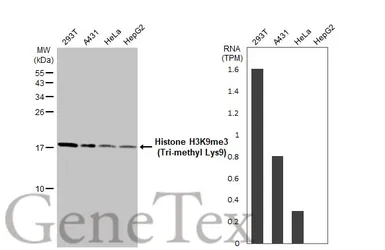 Anti-Histone H3K9me3 (Tri-methyl Lys9) antibody [HL2149] used in Western Blot (WB). GTX638127
