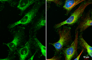 Anti-LGALS3BP antibody [HL2168] used in Immunocytochemistry/ Immunofluorescence (ICC/IF). GTX638146