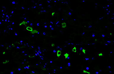 Anti-BCA1 antibody [HL2172] used in IHC (Paraffin sections) (IHC-P). GTX638176