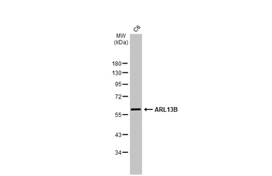 Anti-ARL13B antibody [HL2173] used in Western Blot (WB). GTX638177