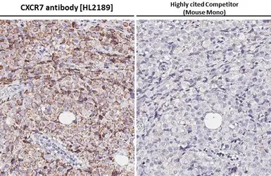 Anti-CXCR7 antibody [HL2189] used in IHC (Paraffin sections) (IHC-P). GTX638193
