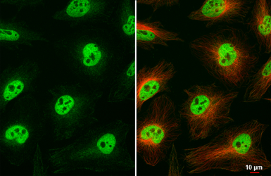 Anti-CBP antibody [HL2197] used in Immunocytochemistry/ Immunofluorescence (ICC/IF). GTX638201