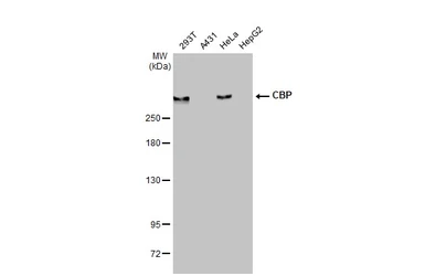 Anti-CBP antibody [HL2197] used in Western Blot (WB). GTX638201