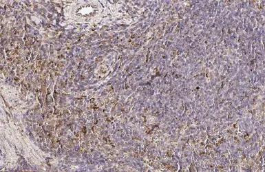 Anti-PFKFB4 antibody [HL2204] used in IHC (Paraffin sections) (IHC-P). GTX638208
