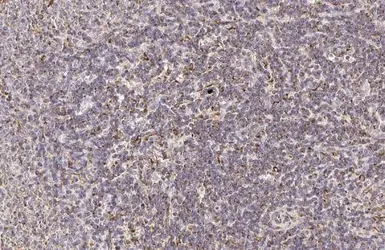 Anti-PFKFB4 antibody [HL2204] used in IHC (Paraffin sections) (IHC-P). GTX638208