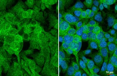 Anti-Angiogenin antibody [HL2214] used in Immunocytochemistry/ Immunofluorescence (ICC/IF). GTX638218