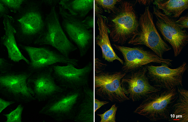 Anti-mTOR antibody [HL2216] used in Immunocytochemistry/ Immunofluorescence (ICC/IF). GTX638220