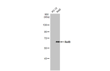Anti-RelB antibody [HL2222] used in Western Blot (WB). GTX638267