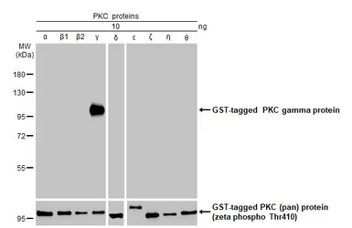 Anti-PKC gamma antibody [HL2226] used in Western Blot (WB). GTX638271