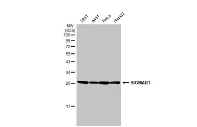 Anti-SIGMAR1 antibody [HL2230] used in Western Blot (WB). GTX638275