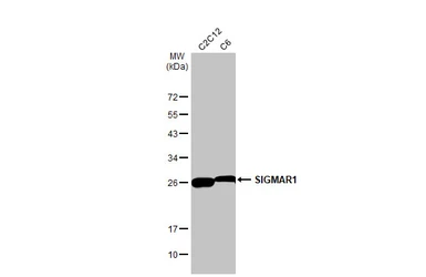 Anti-SIGMAR1 antibody [HL2230] used in Western Blot (WB). GTX638275