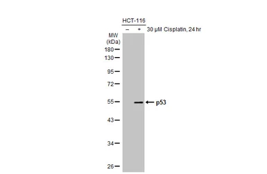 Anti-p53 antibody [HL2242] used in Western Blot (WB). GTX638291