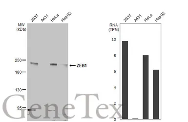Anti-ZEB1 antibody [HL2245] used in Western Blot (WB). GTX638294