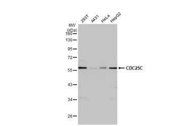 Anti-CDC25C antibody [HL2255] used in Western Blot (WB). GTX638307
