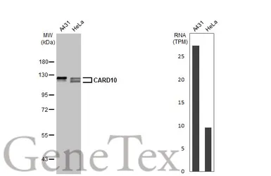 Anti-CARD10 antibody [HL2261] used in Western Blot (WB). GTX638313