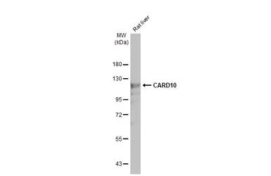 Anti-CARD10 antibody [HL2261] used in Western Blot (WB). GTX638313