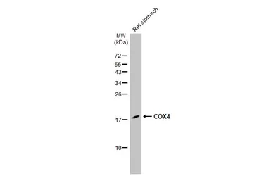 Anti-COX4 antibody [HL2264] used in Western Blot (WB). GTX638316