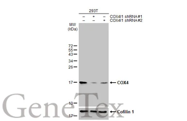 Anti-COX4 antibody [HL2264] used in Western Blot (WB). GTX638316