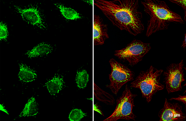 Anti-COX4 antibody [HL2264] used in Immunocytochemistry/ Immunofluorescence (ICC/IF). GTX638316
