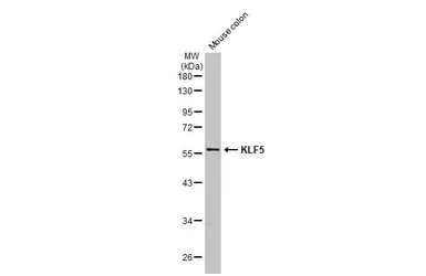 Anti-KLF5 antibody [HL2269] used in Western Blot (WB). GTX638321