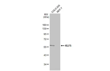 Anti-KLF5 antibody [HL2269] used in Western Blot (WB). GTX638321