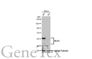 Anti-KLF5 antibody [HL2269] used in Western Blot (WB). GTX638321