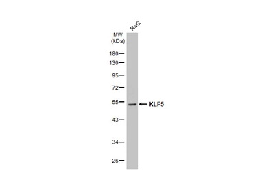 Anti-KLF5 antibody [HL2269] used in Western Blot (WB). GTX638321