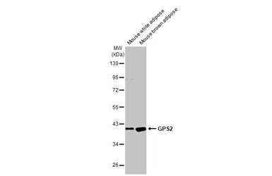 Anti-GPS2 antibody [HL2276] used in Western Blot (WB). GTX638329