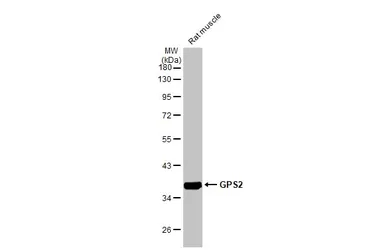 Anti-GPS2 antibody [HL2276] used in Western Blot (WB). GTX638329