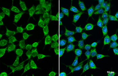 Anti-GPS2 antibody [HL2276] used in Immunocytochemistry/ Immunofluorescence (ICC/IF). GTX638329
