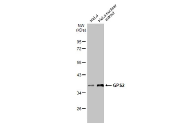 Anti-GPS2 antibody [HL2276] used in Western Blot (WB). GTX638329