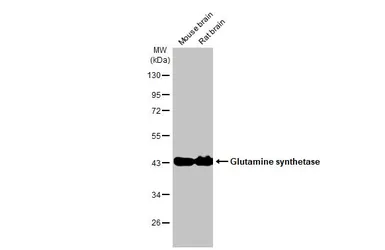 Anti-Glutamine synthetase antibody [HL2283] used in Western Blot (WB). GTX638336