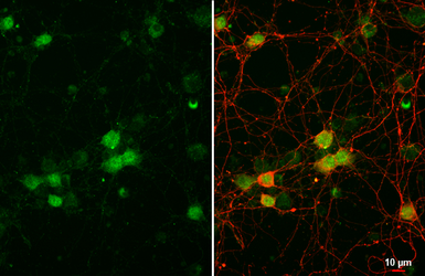 Anti-Brachyury antibody [HL2285] used in Immunocytochemistry/ Immunofluorescence (ICC/IF). GTX638338