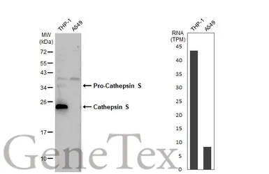 Anti-Cathepsin S antibody [HL2302] used in Western Blot (WB). GTX638369