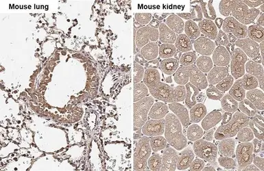 Anti-Cathepsin S antibody [HL2302] used in IHC (Paraffin sections) (IHC-P). GTX638369