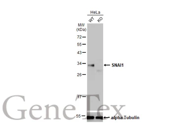 Anti-SNAI1 antibody [HL2303] used in Western Blot (WB). GTX638370