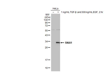 Anti-SNAI1 antibody [HL2303] used in Western Blot (WB). GTX638370